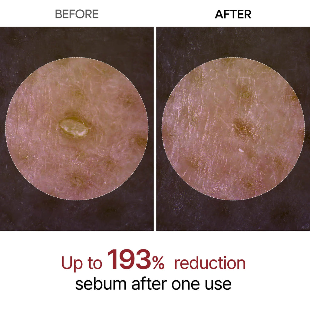 Dr.Melaxin ™ Peel Shot Black Rice Ampoule 80ml