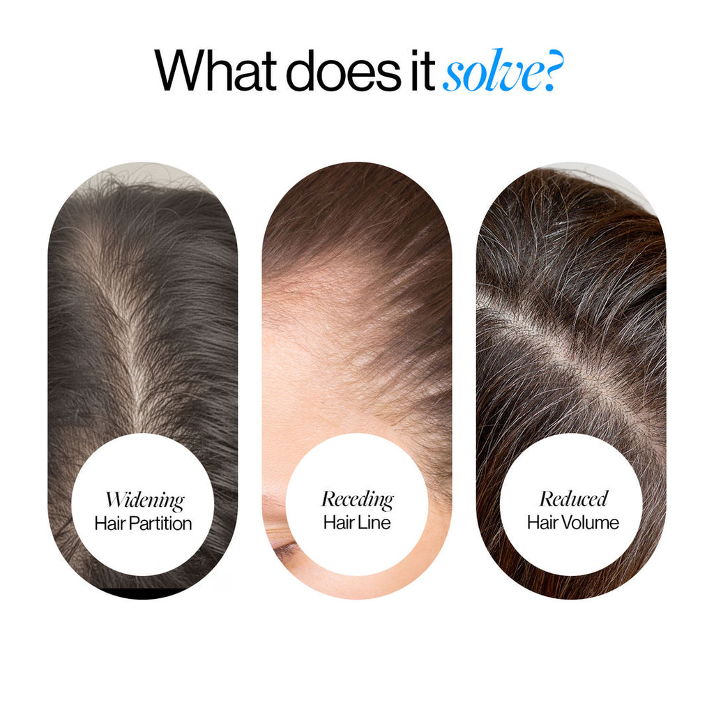 Advanced Hair Growth Serum Roll On (25ml)