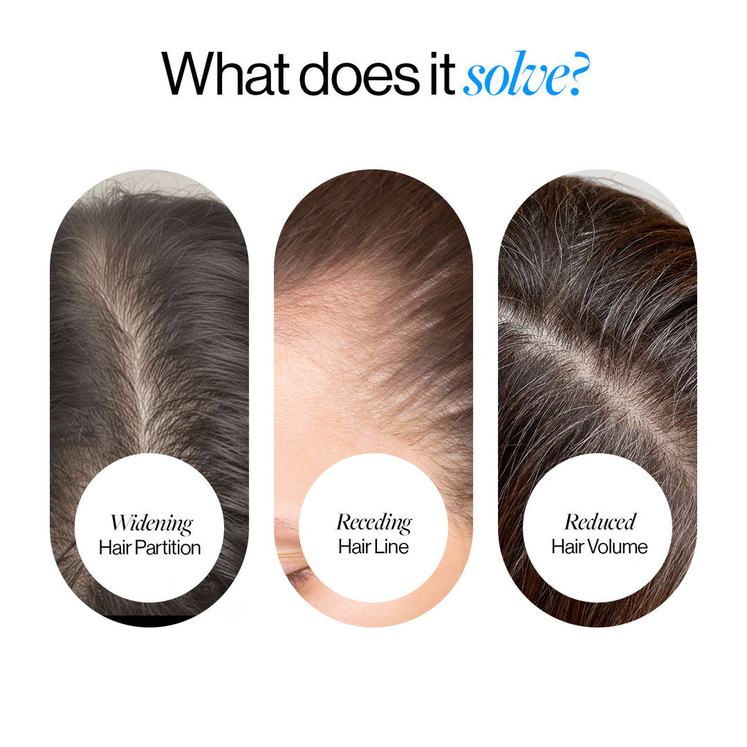 Advanced Hair Growth Serum Roll On (25ml)
