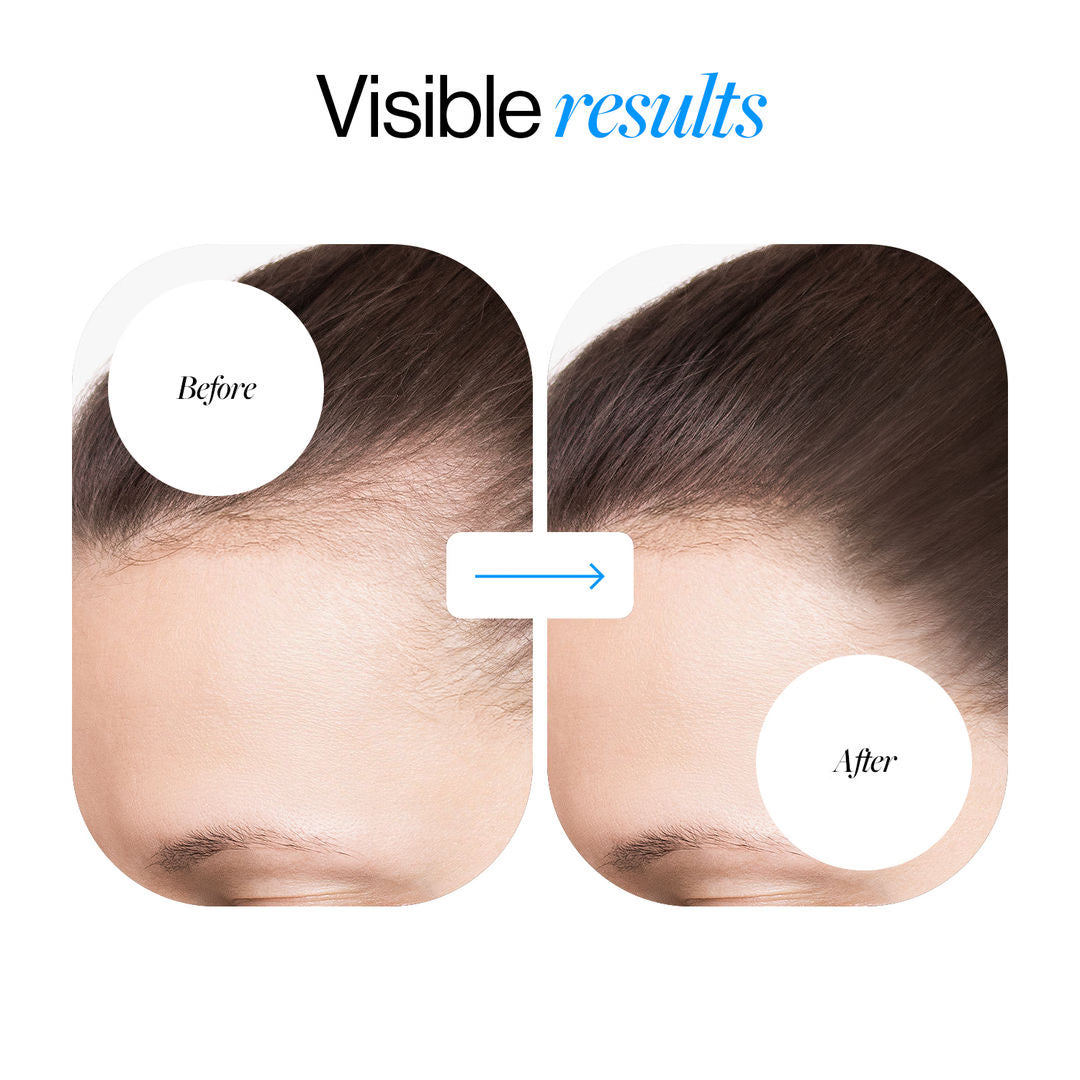 Advanced Hair Growth Serum Roll On (25ml)