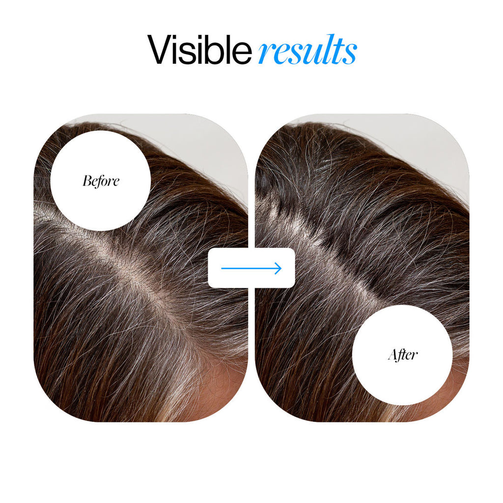 Advanced Hair Growth Serum Roll On (25ml)